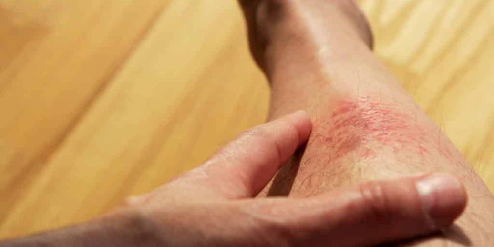 Hard Water Havoc: How It’s Damaging Your Pipes and Skin